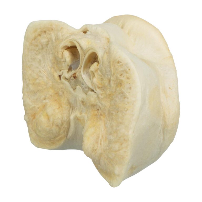 Grisetryne Puffede Natursnack